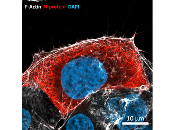 Immunofluorescence of Rabbit Anti-SARS CoV (N) Protein Antibody