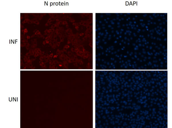 Immunofluorescence assay using Rabbit Anti-SARS-CoV Nucleocapsid (N) Antibody