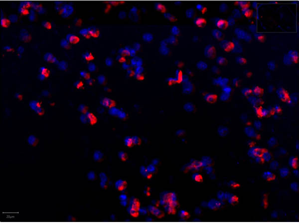 Immunofluorescence of Anti-SARS CoV Nucleocapsid