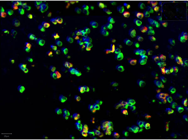 Immunofluorescence of Anti-SARS CoV Nucleocapsid