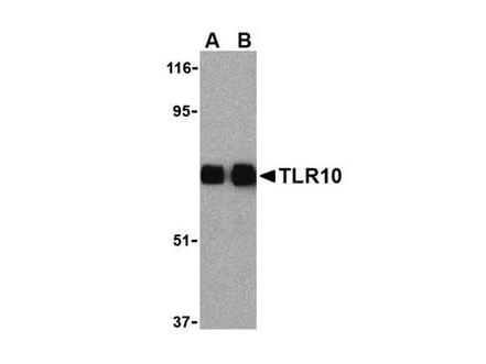Anti-TLR10 Antibody - Western Blot