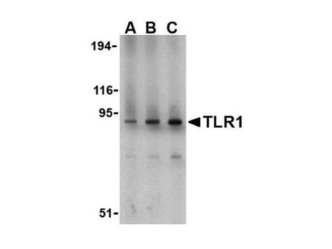 Anti-TLR1 Antibody - Western Blot