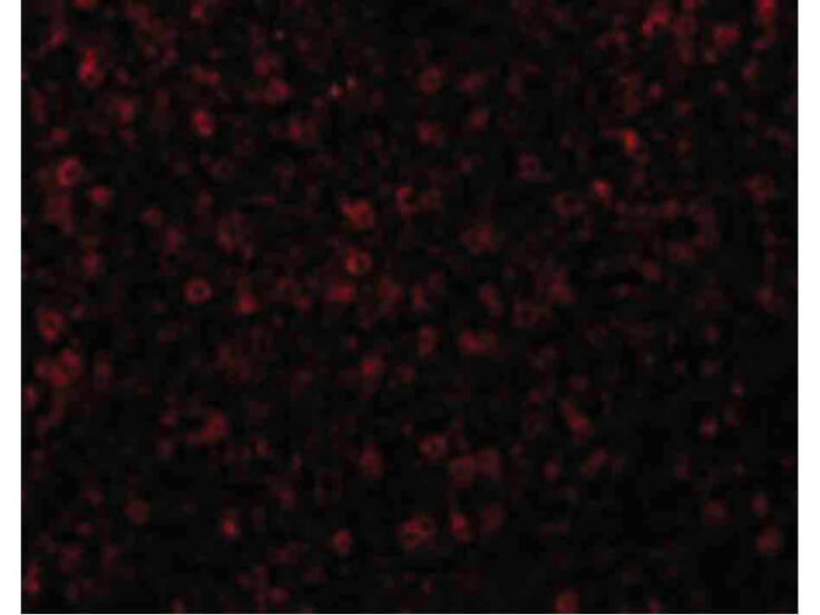 Immunofluorescence of CCR3 Antibody