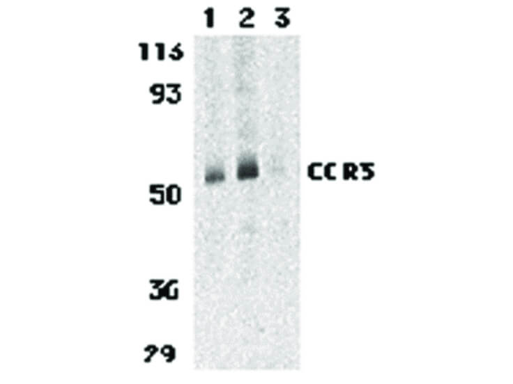 Western Blot of CCR3 Antibody