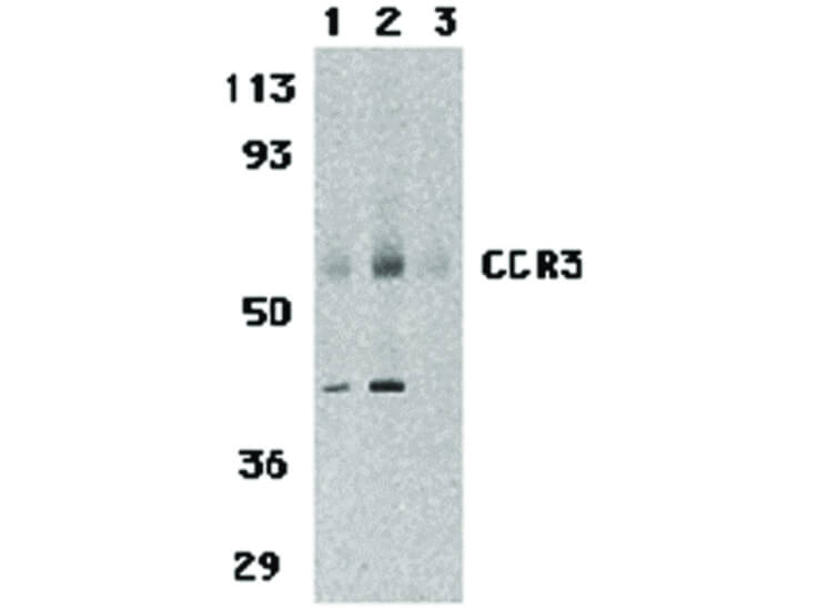 Western Blot of CCR3 Antibody