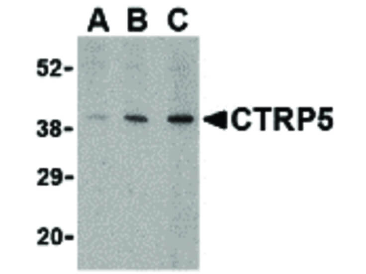 Western Blot of CTRP5 Antibody