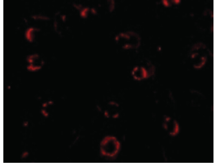Immunofluorescence of CXCR4-Lo Antibody