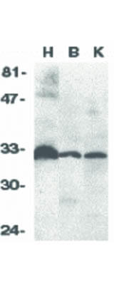 Western Blot of DcR3 Antibody