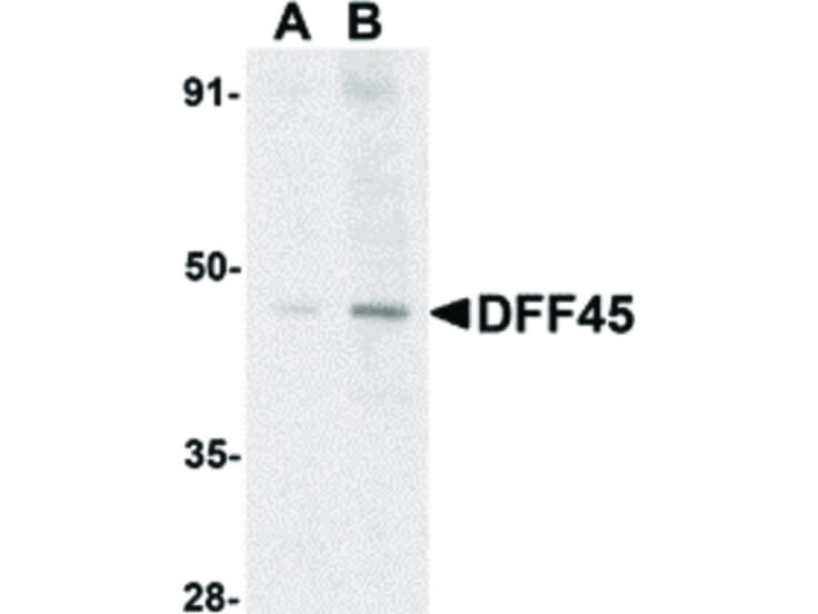 Western Blot of DFF45 Antibody
