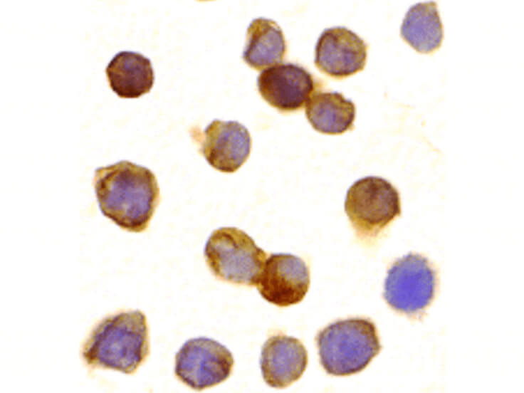 Immunocytochemistry of DR3 Antibody