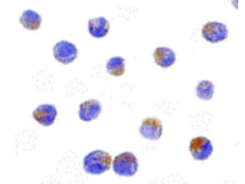 Immunocytochemistry of DRAK2 Antibody