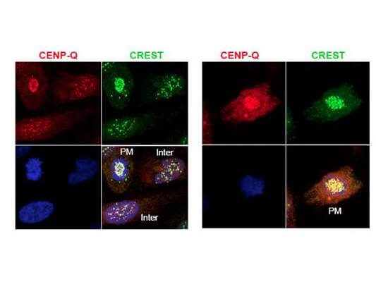 Anti-CENP-Q Antibody - Immunofluorescence Microscopy