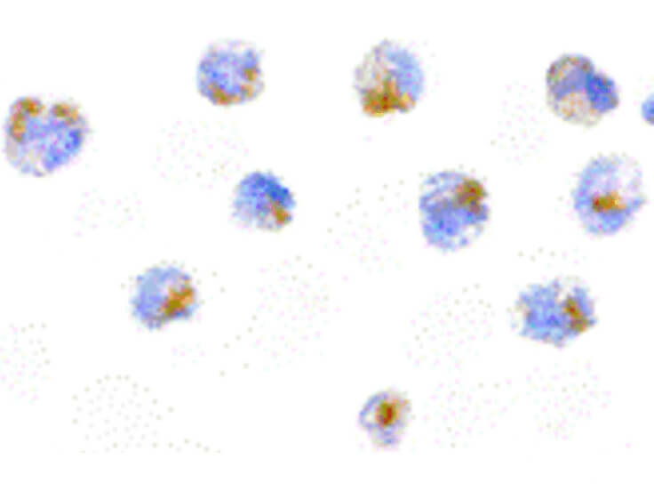 Immunocytochemistry of FLIP Antibody