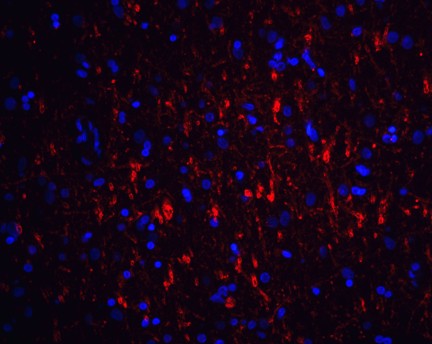 Immunofluorescence of GFR alpha 1