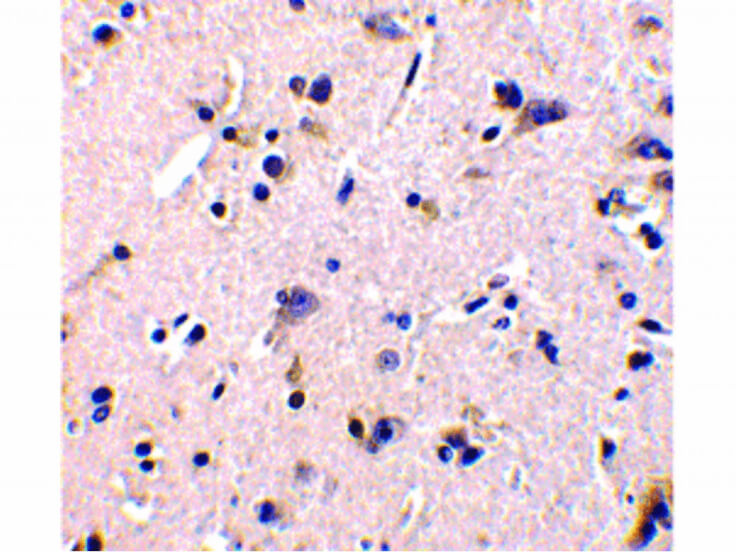 Immunohistochemistry of GFR alpha 1 Antibody