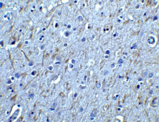 Immunohistochemistry of GFR alpha 1