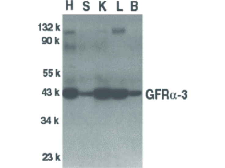 Western Blot of GFR alpha 3 Antibody