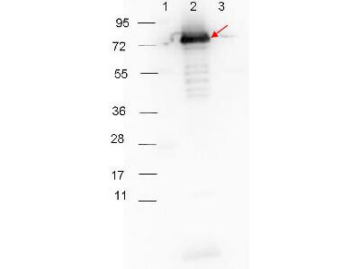 Surface Lipoprotein p27 Antibody