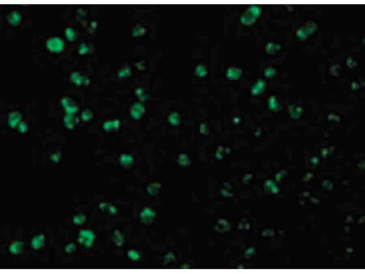 Immunofluorescence of Mcl-1 Antibody