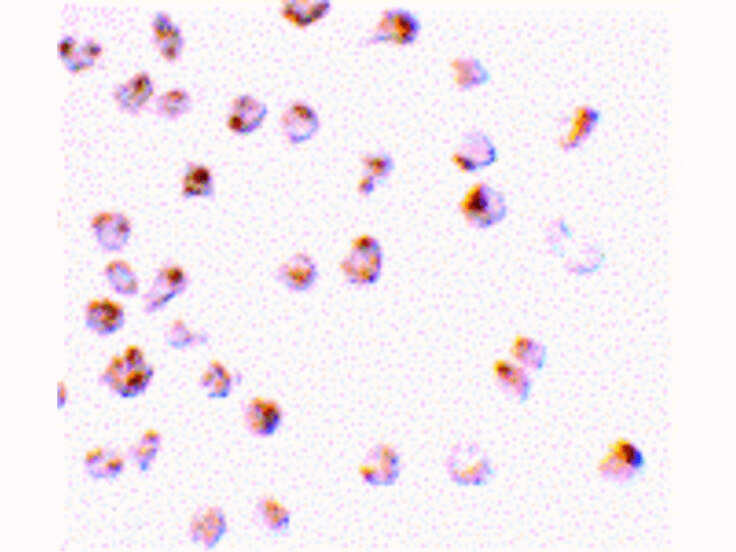 Immunocytochemistry of Mcl-1 Antibody