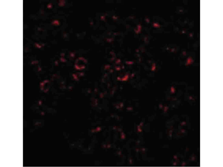 Immunofluorescence of Mcl-1 Antibody