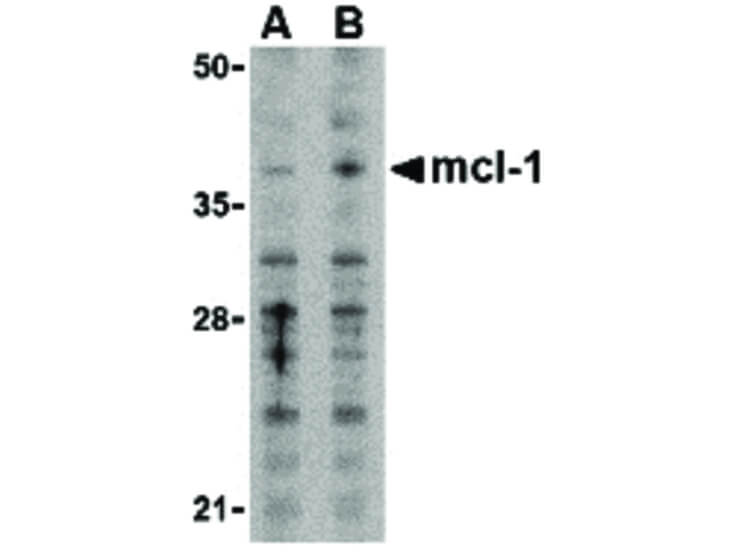 Western Blot of Mcl-1 Antibody