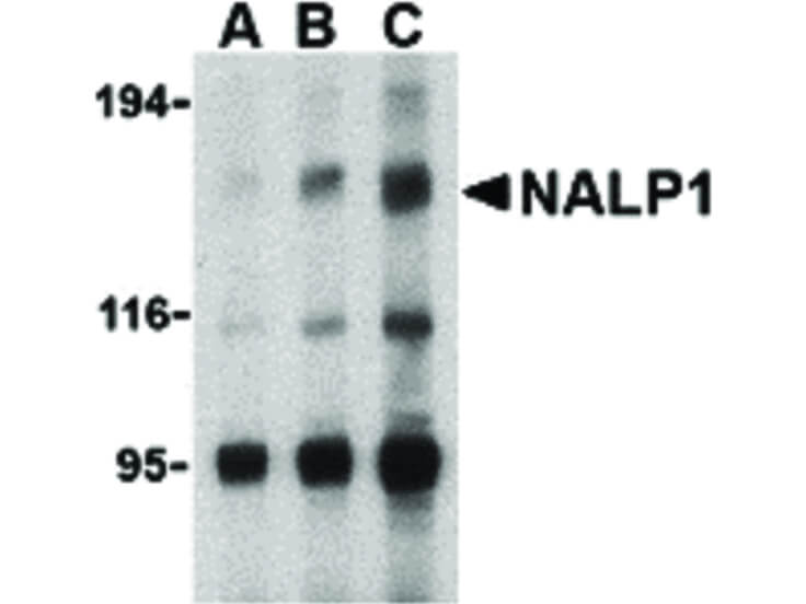 Western Blot of NALP1 Antibody