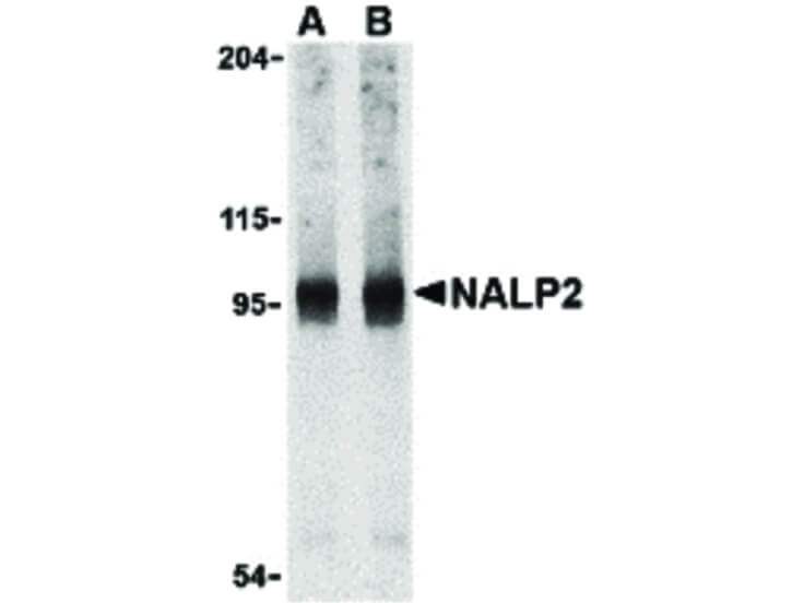 Western Blot of NALP2 Antibody