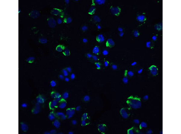 Immunofluorescence of NIK