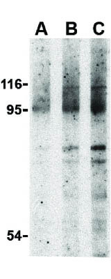 Western Blot of NOD2 Antibody