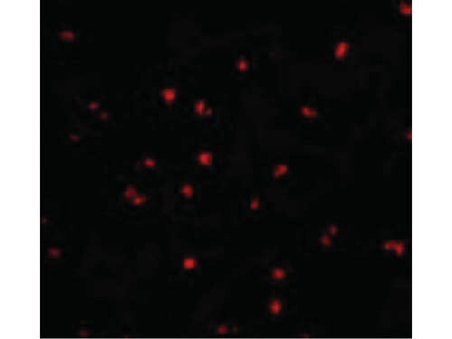 Immunofluorescence of NOD2 Antibody