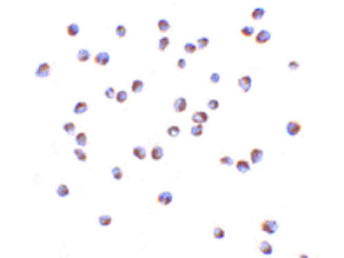 Immunocytochemistry of NOD2 Antibody