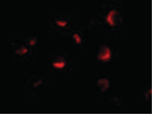Immunofluorescence of PID Antibody