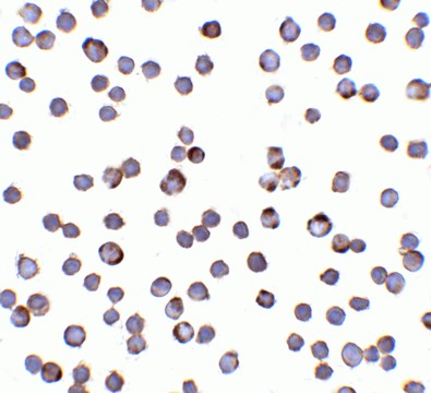 Immunocytochemistry of RAIDD