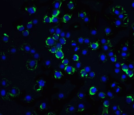 Immunofluorescence of RAIDD