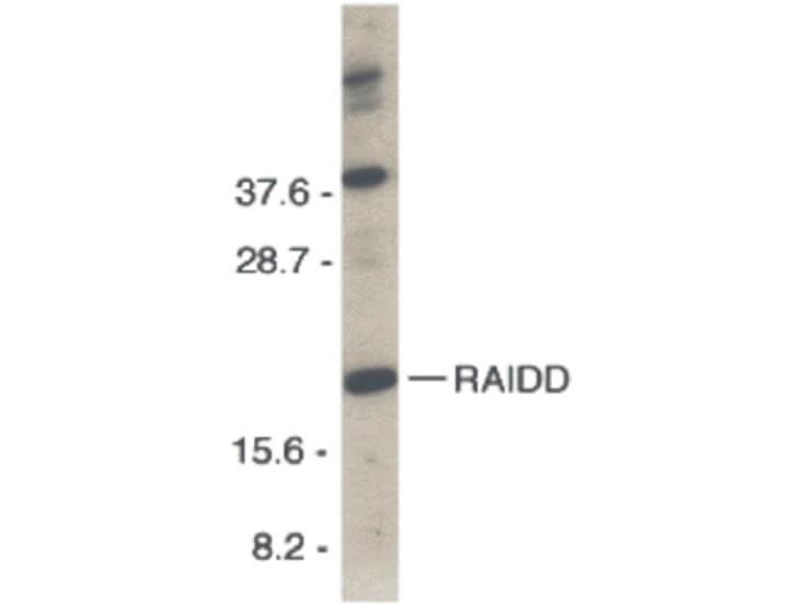 Western Blot of RAIDD Antibody