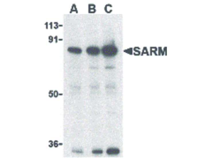 Western Blot of SARM Antibody