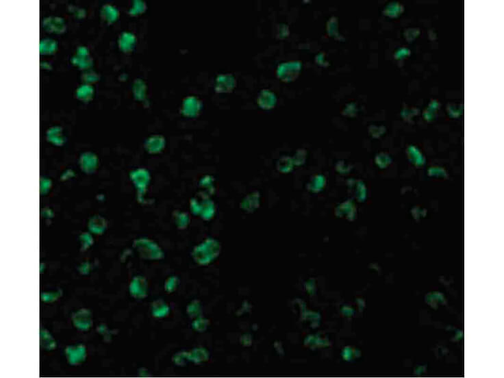 Immunofluorescence of SARM Antibody