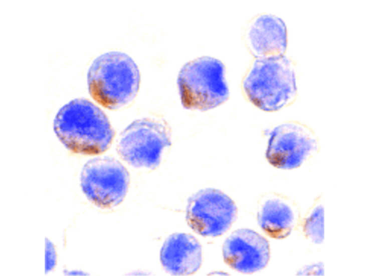 Immunocytochemistry of STAT1 alpha Antibody