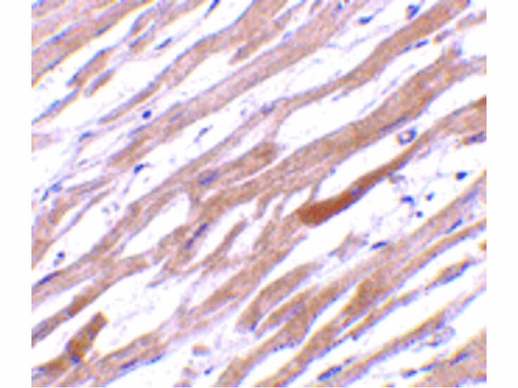 Immunohistochemistry of TIRAP Antibody