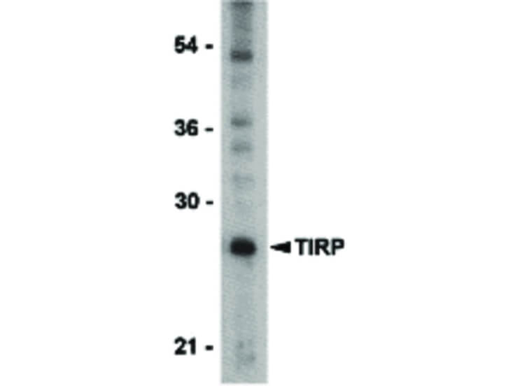 Western Blot of TIRP Antibody