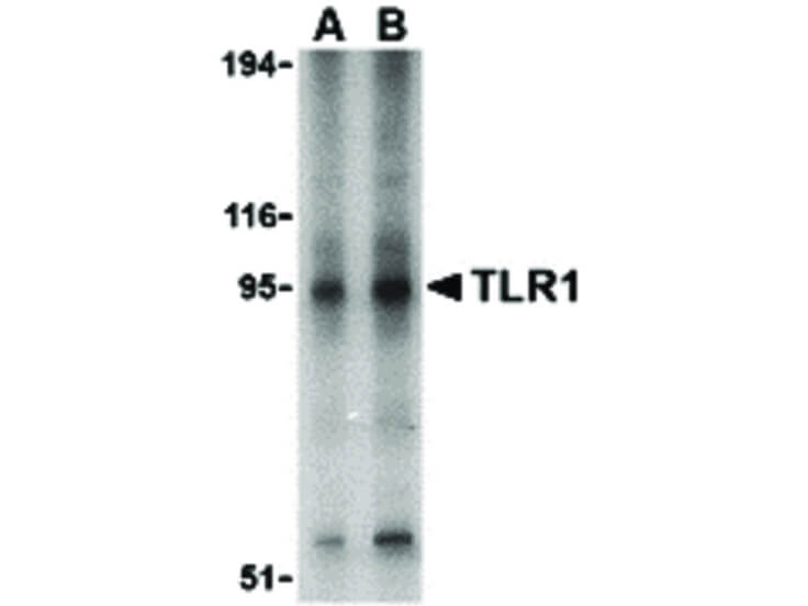Western Blot of TLR1 Antibody