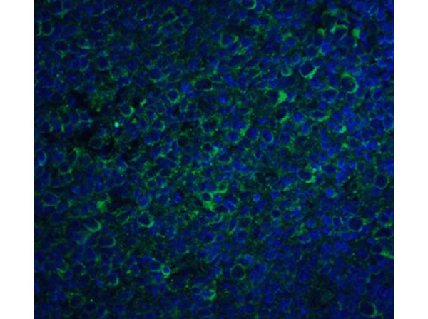 Immunofluorescence of CCR5