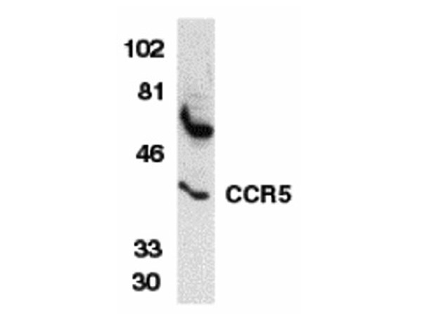 Western blot analysis of CCR5