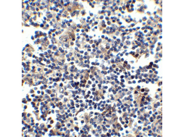 Immunohistochemistry of CCR5