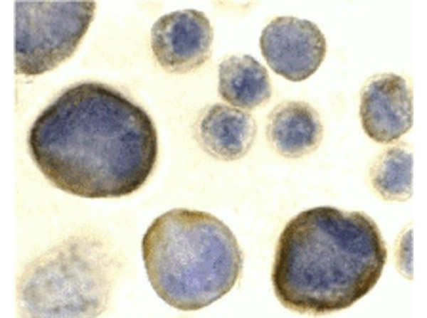 Immunocytochemistry Validation of CXCR4