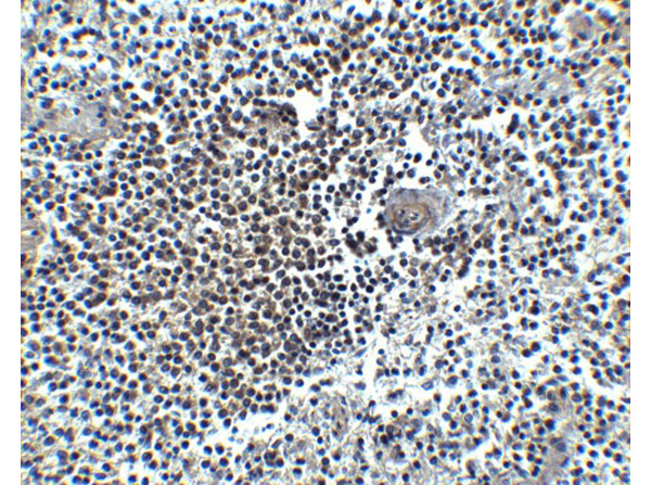 Immunohistochemistry Validation of CXCR4