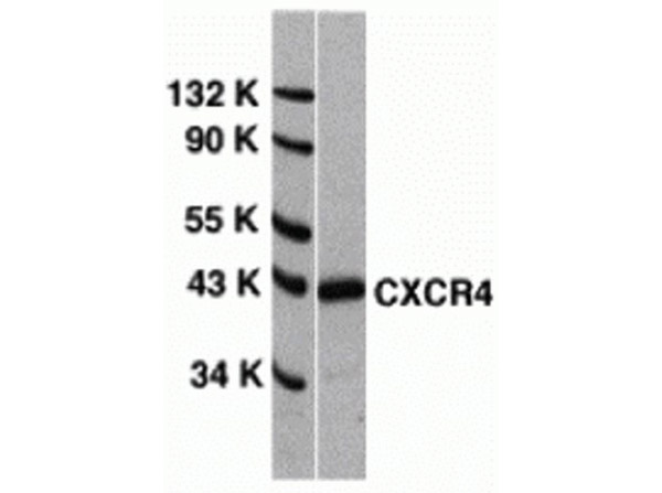 Western Blot Validation of CXCR4