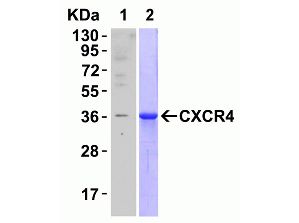 Western Blot Validation of CXCR4