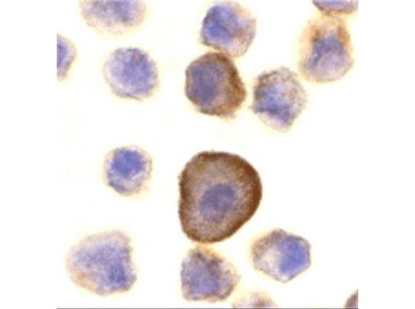 Immunocytochemistry of Anti-PERP